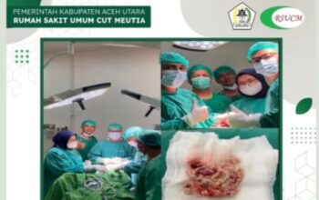 Operasi Tumor Otak Perdana