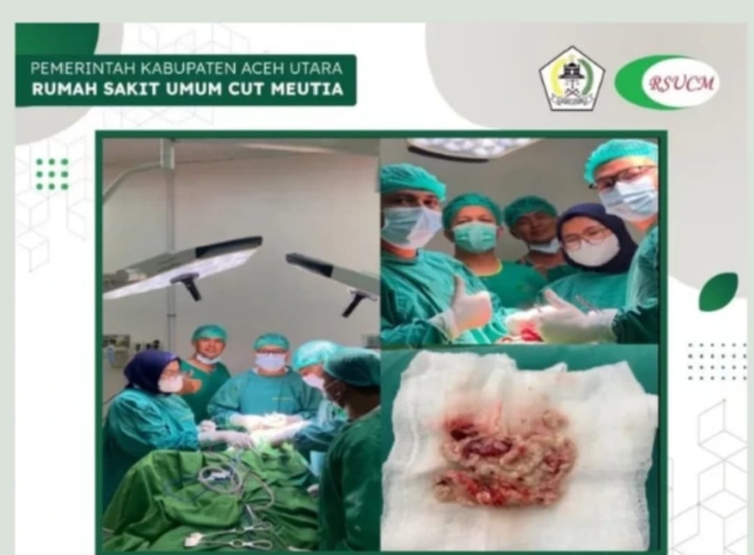 Operasi Tumor Otak Perdana